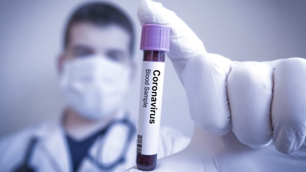 Información sobre el Coronavirus en el sur de California
